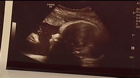 Spiritual Sonogram Offers Local Couple Relief What Do You See