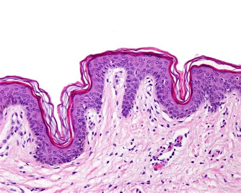 Histología de la piel Histología Imagenes de microscopio Piel