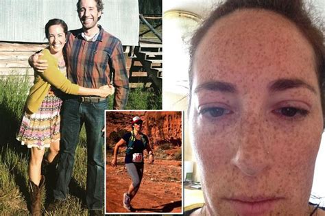 Bride To Be Permanently Scarred After Allergic Reaction To Facial Wax