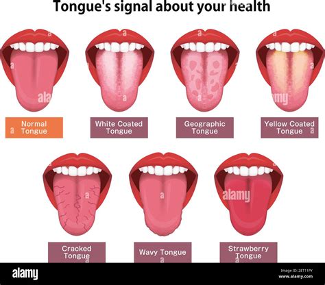 Tongues Health Sign Vector Illustration Set Stock Vector Image And Art