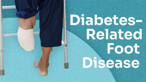 Diabetes Related Foot Disease Explained Ausmed