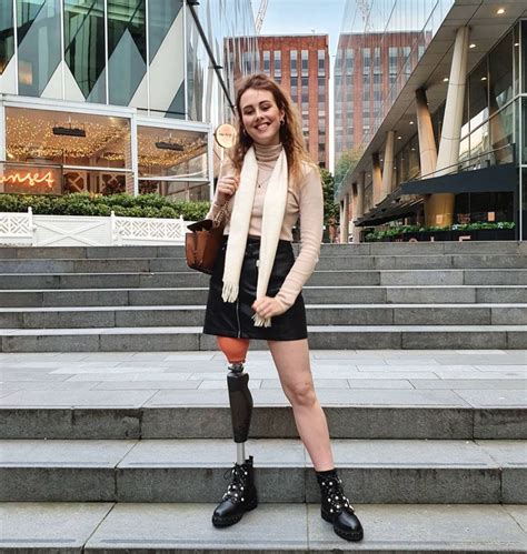 Meet Sarah Dransfield The 24 Year Old Bone Cancer