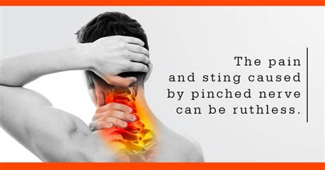 Upper Cervical Care And Pinched Nerve Purity Chiropractic