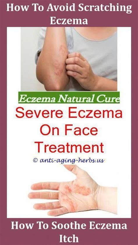 How Can I Treat Eczema Best Shower Oil For Eczemabad Case Of Eczema