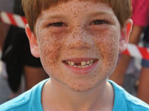 Freckle Contest Was The Spot Thursday On The Boardwalk Ocean City Nj