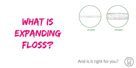 What is Expanding Floss? | The Toothsayer