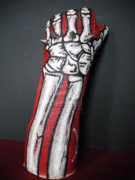 11 Awesomely Decorated Casts Worth A Broken Bone Mental Floss Broken