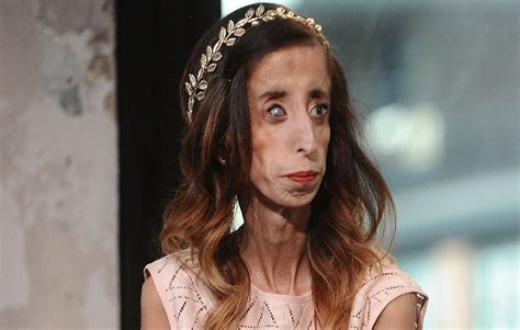 Once Dubbed The Worlds Ugliest Woman Lizzie Velazquez Shuts Down Viral Memes Shaming Her