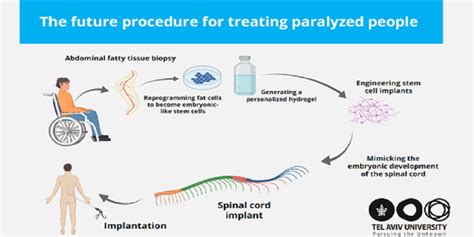 Israels Tau Breakthrough Offers New Hope To Help People With Paralysis Walk Again India Press