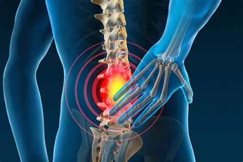 Lower Back Pain Gmphysio