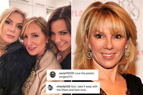 Ramona Singer 64 Slammed For Too Much Plastic Surgery And