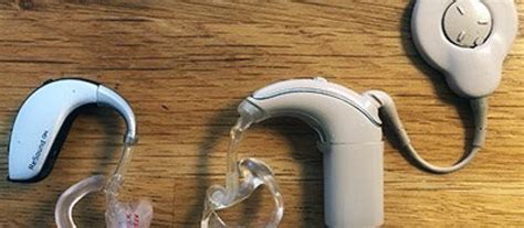 Hearing Aids Versus A Cochlear Implant Which Is Better For Adults