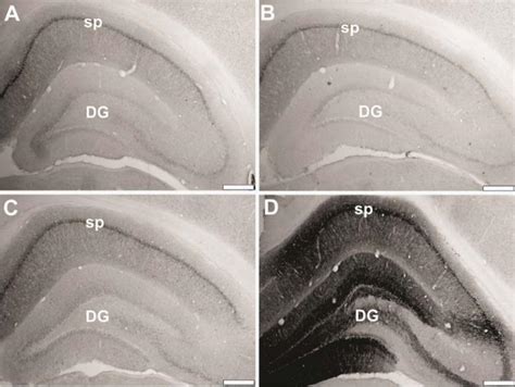 Hippocampal Fkbp1b Image Eurekalert Science News Releases