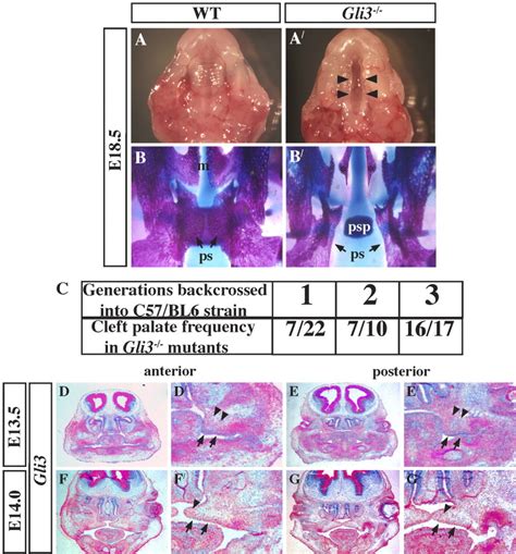 Gli3‐deficient Mice Exhibit Cleft Palate Associated With Abnormal