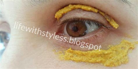 She Started Applying Turmeric Around Her Eyes 10 Minutes Later Amazing