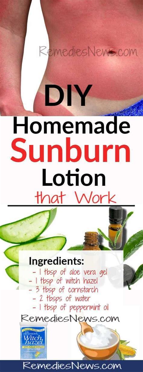 Send thanks to the doctor. How to Get Rid of Sunburn Dark Skin Overnight - 10 Best ...