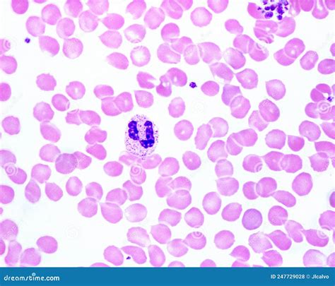 Human Blood Smear Neutrophil Stock Photo Image Of Microscopy Banded