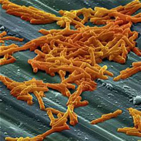 Symptoms include watery diarrhea, fever, nausea, and abdominal pain. Clostridium Difficile Infection Haunts Cervical Disk ...