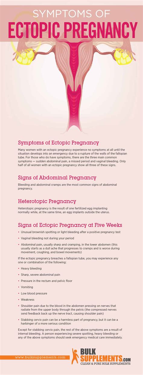 Ectopic Pregnancy Characteristics Causes And Treatment By James Denlinger