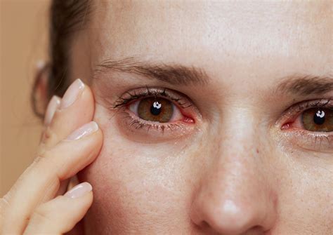 Eye Pain Causes Common Conditions And Treatment
