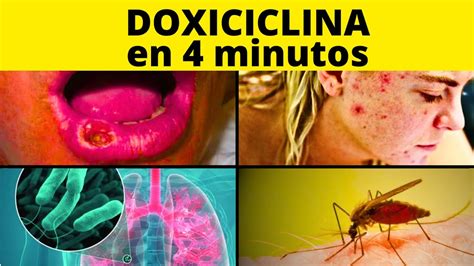 DESCUBRE Para Qué sirve la DOXICICLINA 100 mg en adultos y mucho más