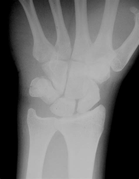 UCSD Musculoskeletal Radiology