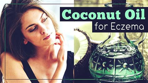 Coconut Oil For Eczema How To Use It Youtube