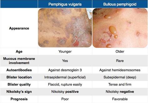 Image Result For Pemphigus Vulgaris Vs Bullous Pemphigoid Nursing