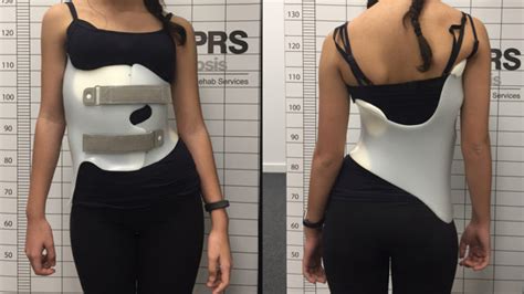 How Do Scoliosis Braces Work