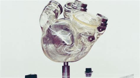 Worlds First Artificial Heart Transplanted Into Patient Mirror Online