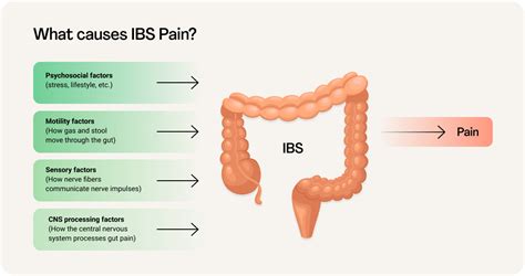 Ibs Pain Guide Types Locations And Treatments