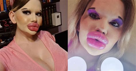 Meet Andrea Ivanova The Woman Who Spent ₹75 Lakhs To Possess The Worlds Biggest Lips Scoopwhoop