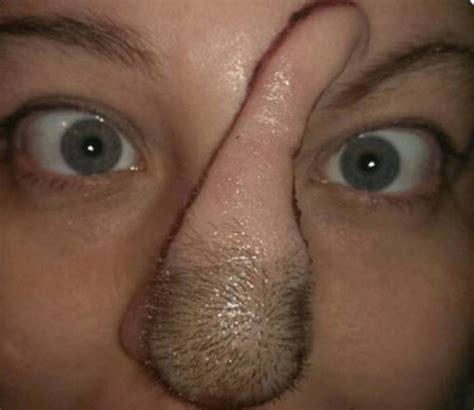 Bree Towner Has New Nose Made From Her Scalp After Skin Cancer