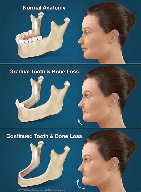 Pin On Oral Health