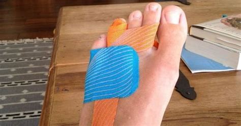 You will be asked how you broke your toe, what symptoms you are having, and what kinds of athletic activities you participate in. KT Tape Pro for broken toes. Since I break my toes all the ...