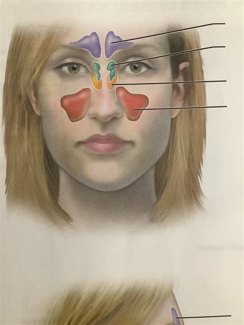 Paranasal Sinuses Anterior View Diagram Quizlet