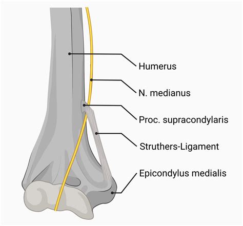 Struthers Ligament Mit Nervus Medianus DocCheck