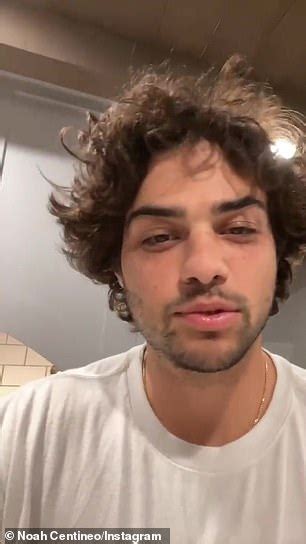 To All The Boys Star Noah Centineo Has Tonsils Removed After Seven