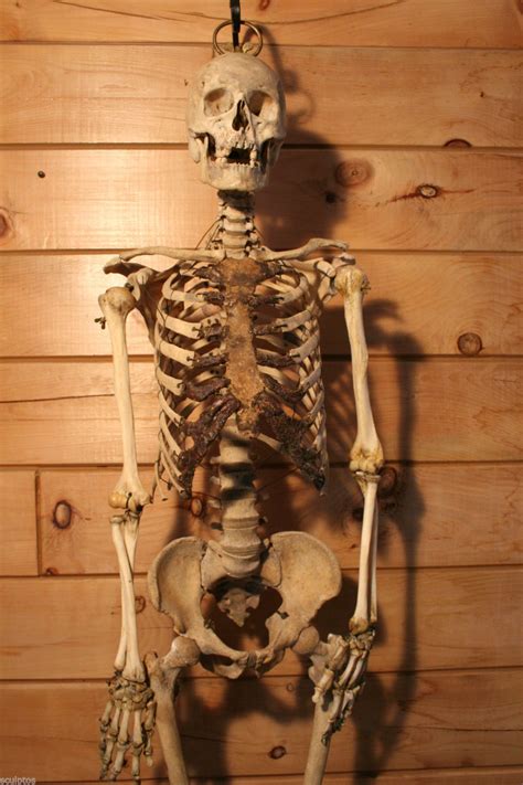 Real Human Adult Male Skeleton Skull Antique Oddity For Scientific