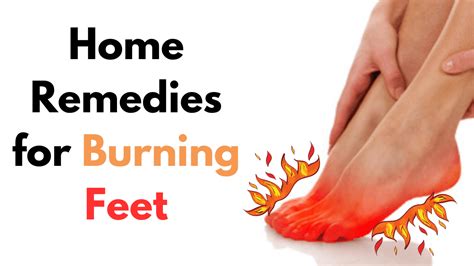 10 Effective Home Remedies For Burning Feet Natural Solutions For Foot Discomfort