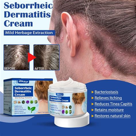 Seborrheic Dermatitis Cream Psoriasis Anti Itch Cream Soothing