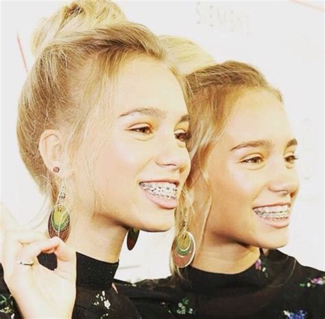 Lisa And Lena Perfect Teeth Braces Girls Cute Braces