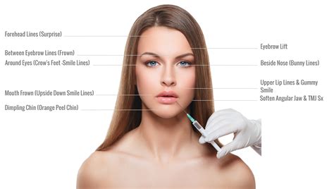 The cost of a botox treatment for frown lines or crows. FAQ Botox Cosmetic | Dr. Jiwani Naturopathic Vancouver Surrey