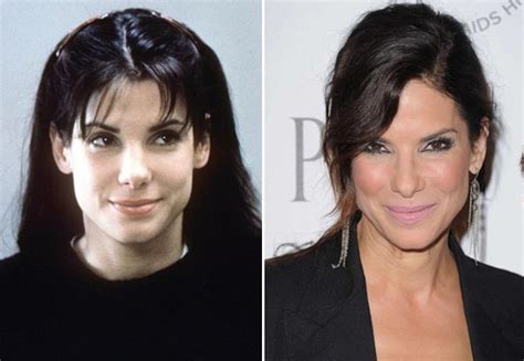 Hollywood Celebs Who Looked Better Before Plastic Surgery