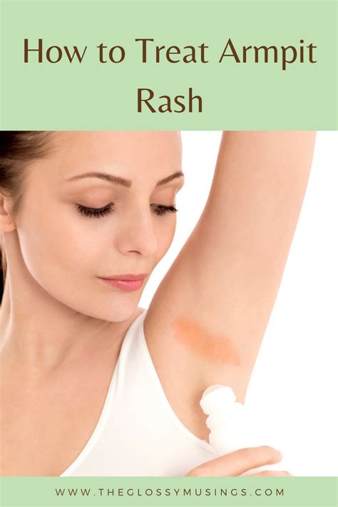 How To Get Rid Of Armpit Rash In 2021 Armpit Rash Rashes Fungal Rash