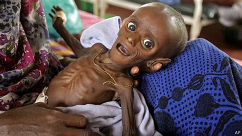 الأمم المتحدة 130 مليون شخص على حافة المجاعة بحلول نهاية العام لكم