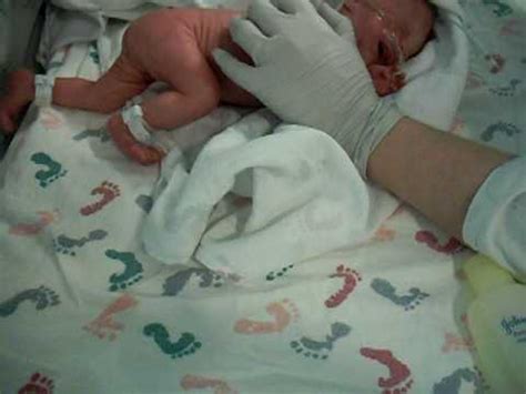 They have cycles of sleeping and waking. What a baby looks like at 30 weeks gestation. Anti ...