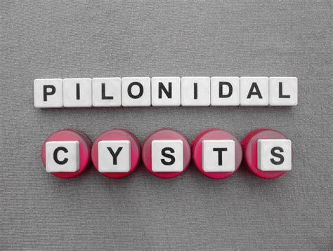 Pit Picking Pilonidal Cyst Advanced Surgical Physicians