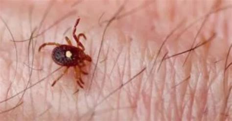 Severe Meat Allergy Caused By Tick Bites Genetic And Molecular
