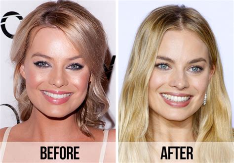 Fans Spot A Huge Difference In Margot Robbies Appearance After Looking At Before And After
